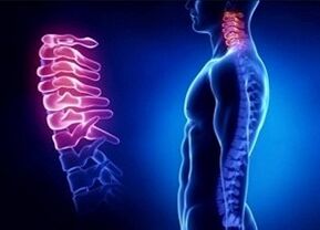 Causes of the Cervical Osteochondrosis